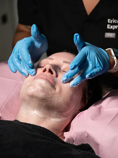 Applying a chemical peel treatment to a client’s face for exfoliation, brightening, and skin rejuvenation