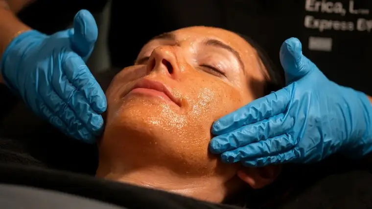Chemical Peels - VI Peel 