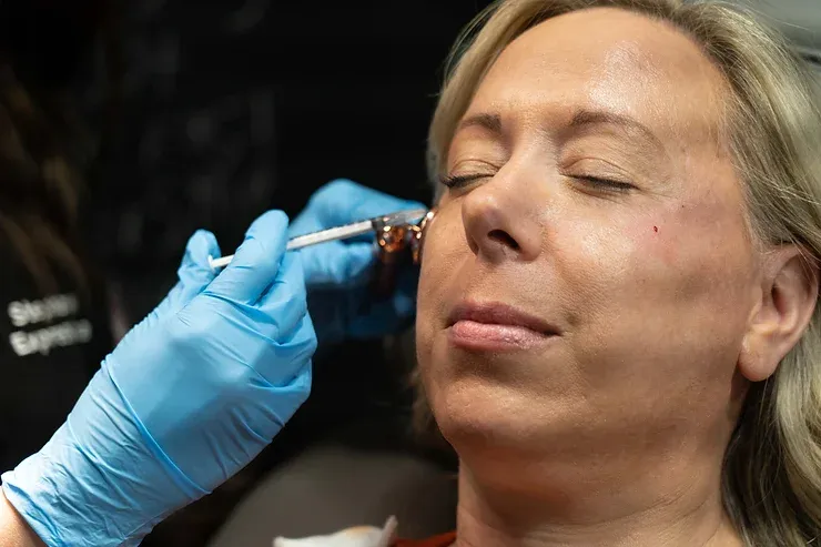 Radiesse filler benefits for long-lasting facial volume and contour enhancement