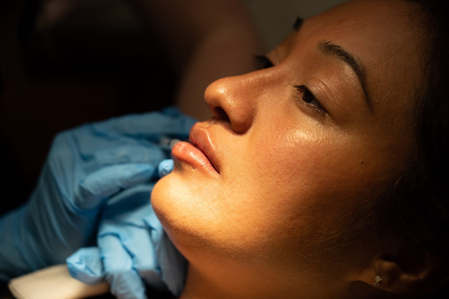 Client admiring refreshed lips after a Revanesse Lips treatment for enhanced volume and definition